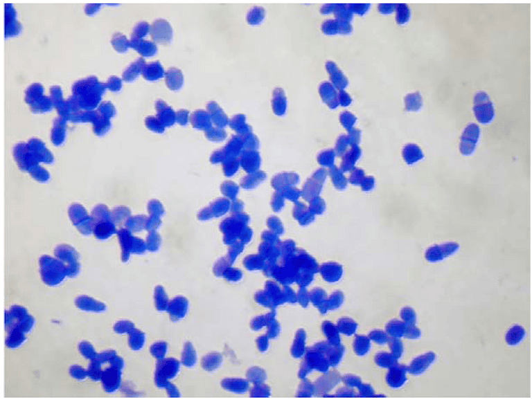 Malassezia species image under microscope